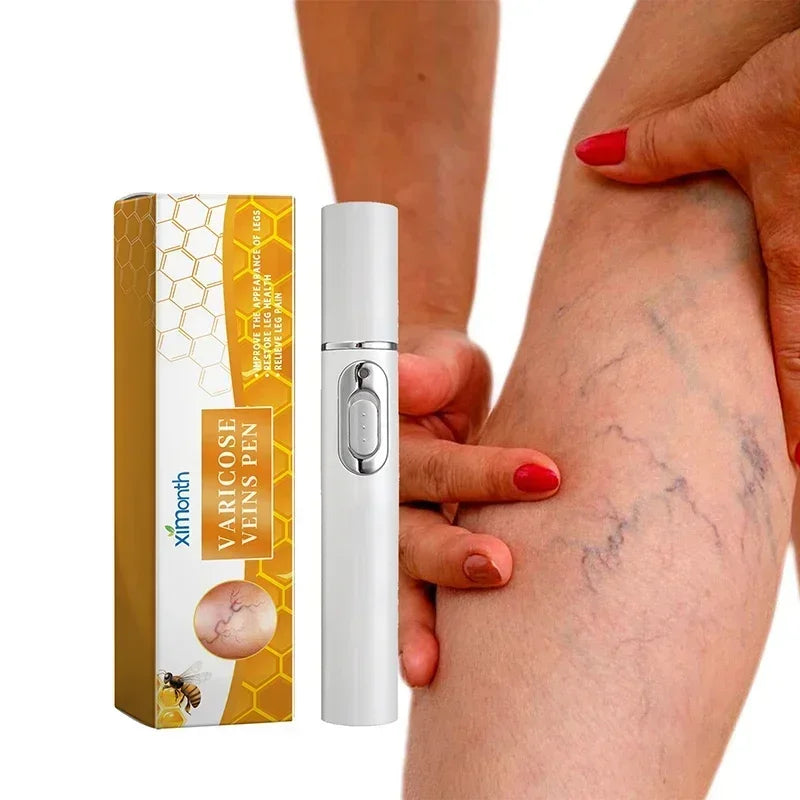 Laser Therapy Leg Repair Pen Reduce Imcomfortable For Legs Improving Blood Circulation Varicose Veins Pen Skin Care Product