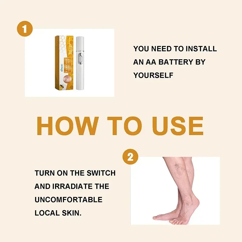 Laser Therapy Leg Repair Pen Reduce Imcomfortable For Legs Improving Blood Circulation Varicose Veins Pen Skin Care Product