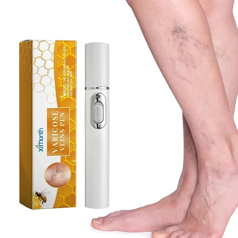 Laser Therapy Leg Repair Pen Reduce Imcomfortable For Legs Improving Blood Circulation Varicose Veins Pen Skin Care Product