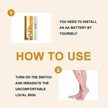 Laser Therapy Leg Repair Pen Reduce Imcomfortable For Legs Improving Blood Circulation Varicose Veins Pen Skin Care Product