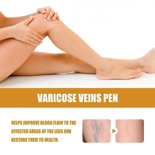 Laser Therapy Leg Repair Pen Reduce Imcomfortable For Legs Improving Blood Circulation Varicose Veins Pen Skin Care Product