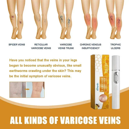 Laser Therapy Leg Repair Pen Reduce Imcomfortable For Legs Improving Blood Circulation Varicose Veins Pen Skin Care Product
